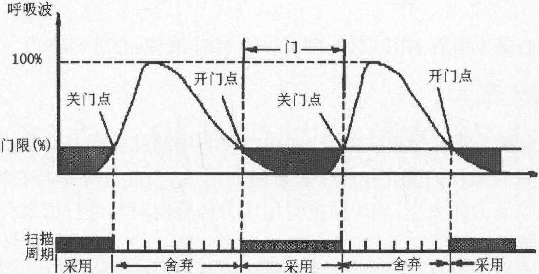 三、呼吸補(bǔ)償和呼吸門(mén)控技術(shù)